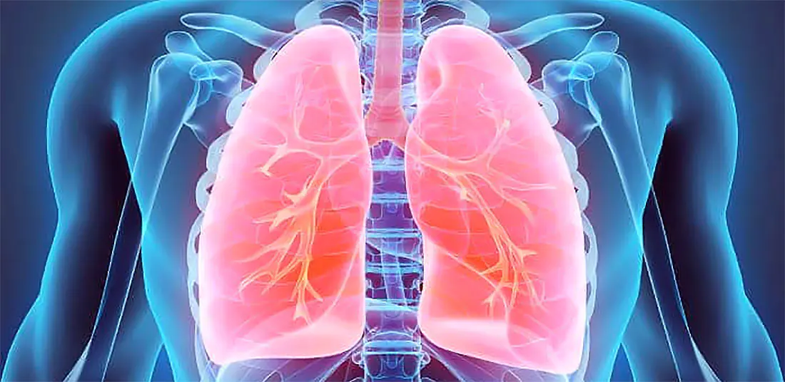 Vaping and lung capacity Vaping and lung capacity compared with combustible tobacco